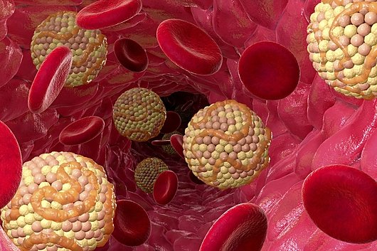 New Cholesterol Guidelines Urge Earlier Treatment and Lower Lipid Targets for Heart Disease Prevention