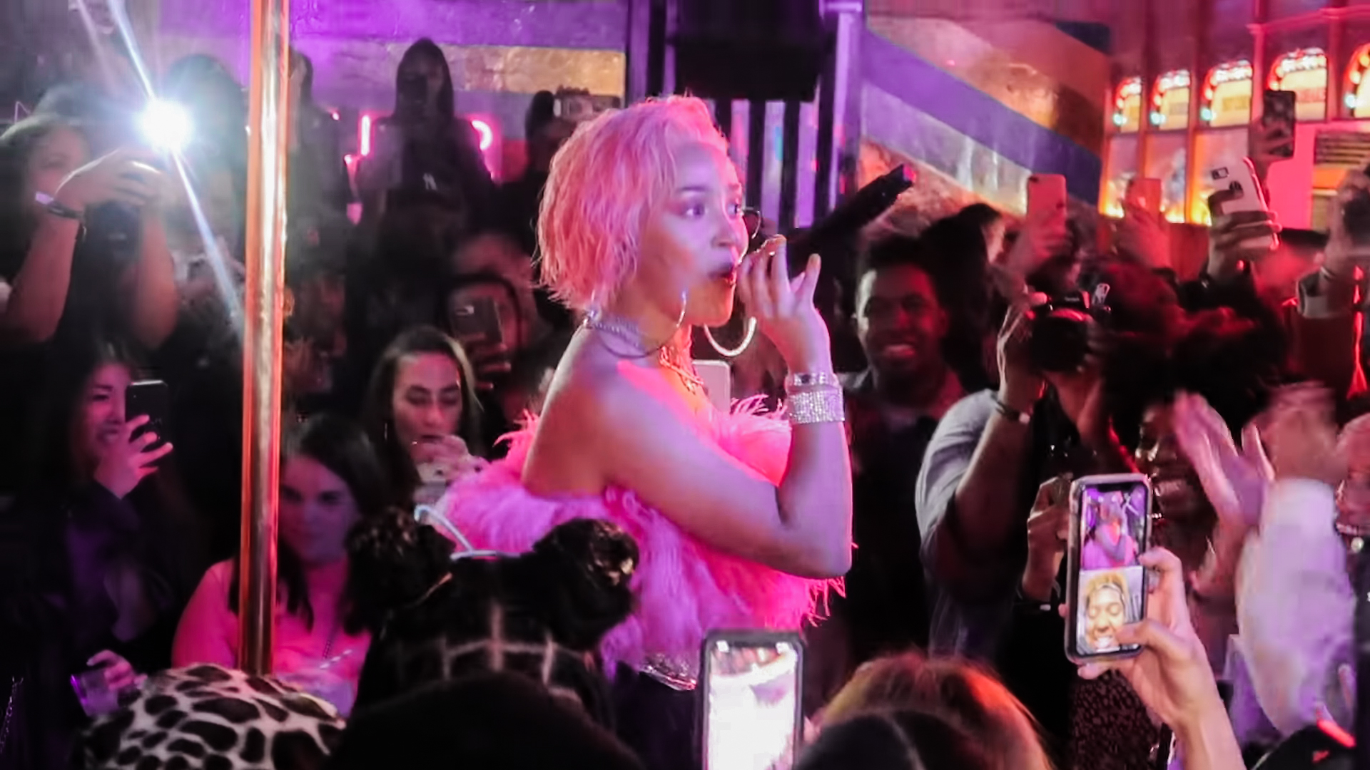 Doja Cat's Lipedema Disclosure Shines Light on Underdiagnosed Condition Affecting Millions of Women