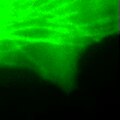 Scientists Discover Internal "Wind System" in Cells That May Explain How Cancer Spreads