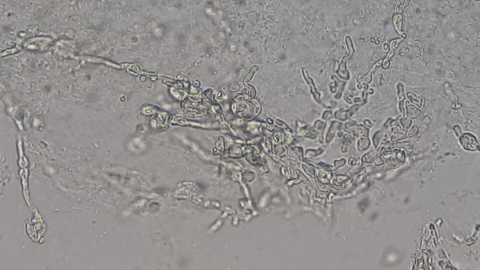 New Urine Test Could Identify the Right UTI Antibiotic in Under Six Hours
