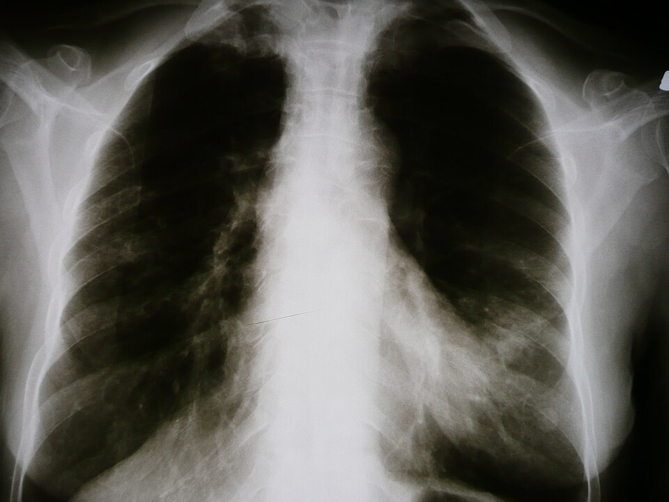 Medical X-rays