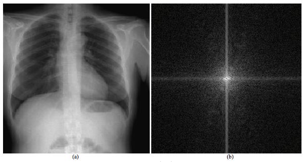 A chest radiograph is illustrated in (a) with its 2-D Fourier spectrum in (b). The spatial frequency data show a broad range of values with significant vertical and horizontal features associated with the vertebral column and ribs, respectively.