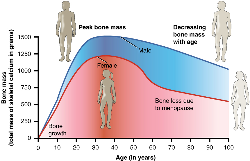 Bone density peaks at about 30 years
of age. Women lose bone mass more rapidly than men.