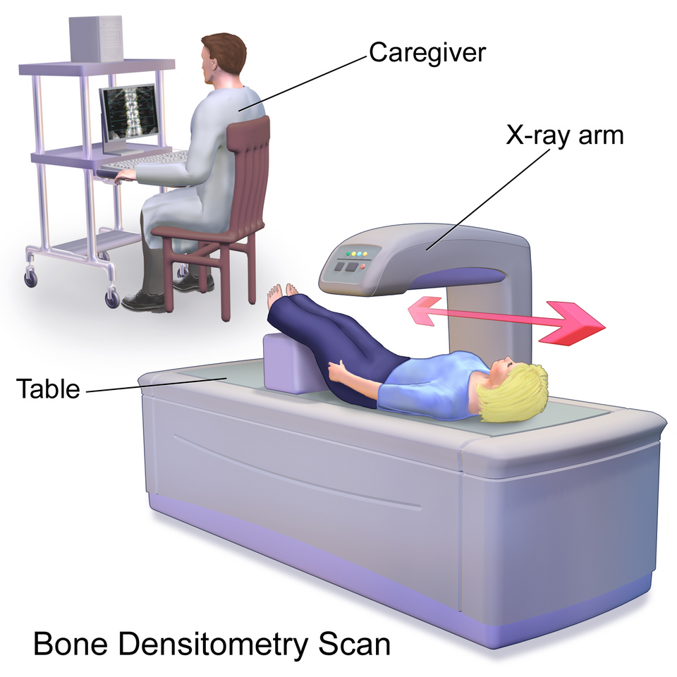 Bone Densitometry Scan.  This image was donated by Blausen Medical. Please visit our website to see more medical illustrations and animations.