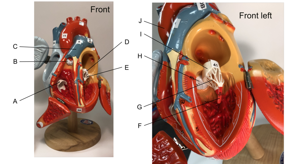 Anatomical heart models with atria and ventricles opened up to expose the valves. On the left, a front view of the entire heart; on the right a front view of just the left heart. A - Tricuspid valve; B - Pulmonary valve; C - Pulmonary artery; D - Bicuspid/mitral valve; E - Chordae tendineae; F - Pap