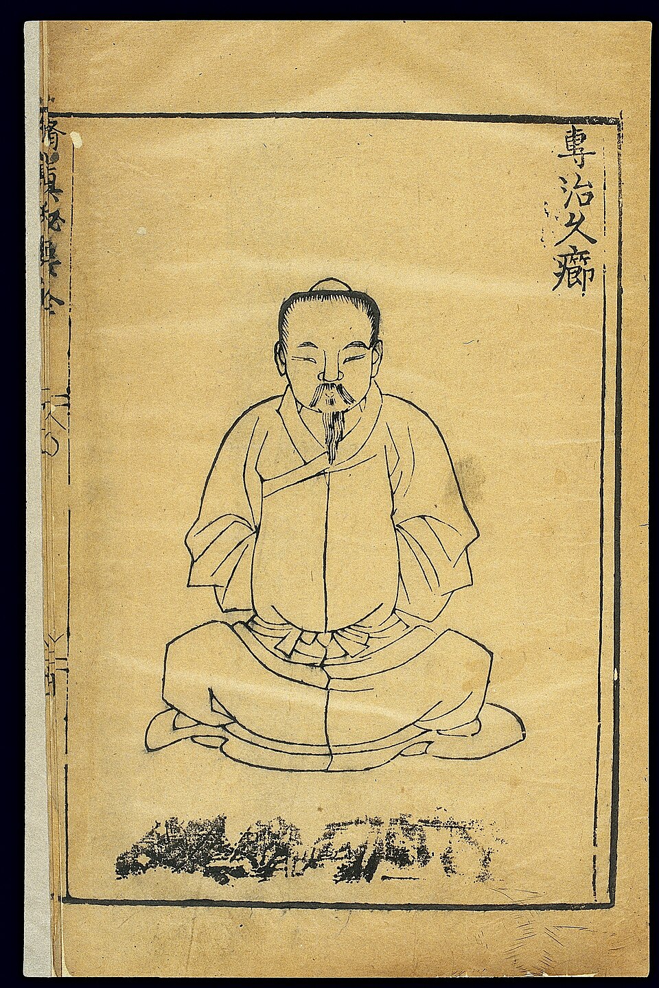 Xiuzhen miyao, a gymnastic (daoyin/qigong) text of unknown origin, was rediscovered and published with a preface by Wang Zai in 1513 (8th year of the Zhengde reign period of the Ming dynasty). It records 49 exercises. This illustration depicts a technique designated aszhuan zhi jiu jie(specific cure
