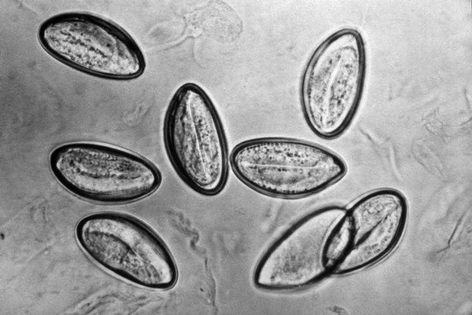 Image of the eggs of the human parasite Enterobius vermicularis, or “human pinworm”, captured on cellulose tape under significant magnification.