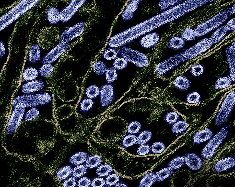 Colorized transmission electron micrograph of avian influenza A H5N1 virus particles (purple), grown in Madin-Darby Canine Kidney (MDCK) epithelial cells. Microscopy by CDC; repositioned and recolored by NIAID. Credit: CDC and NIAID 
Featuring Halloween-appropriate colors, which tend to be popular y