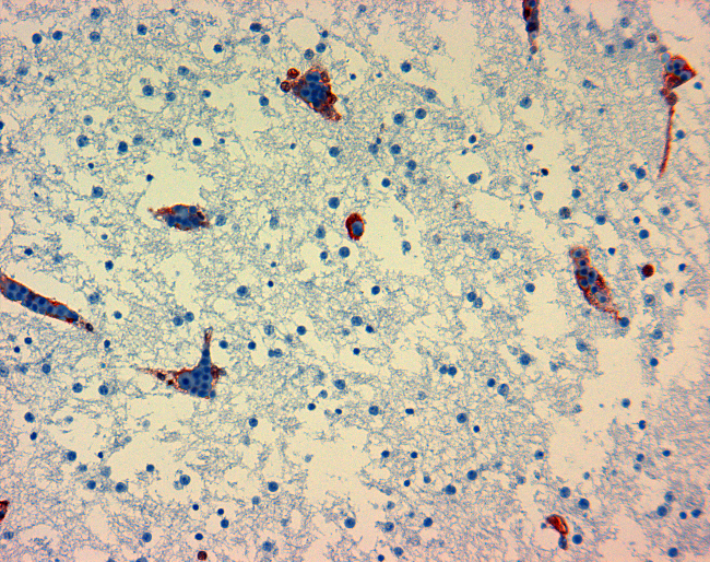 Avian influenza is a highly lethal viral disease of birds. In some cases, the disease can be spread to humans. This slide shows the H5N1 strain of avian influenza in the brain of a chicken embryo. The virus is indicated by the red stain.  Please note that this image is available at low resolution on
