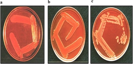 Cultures of Shigella bacteria.