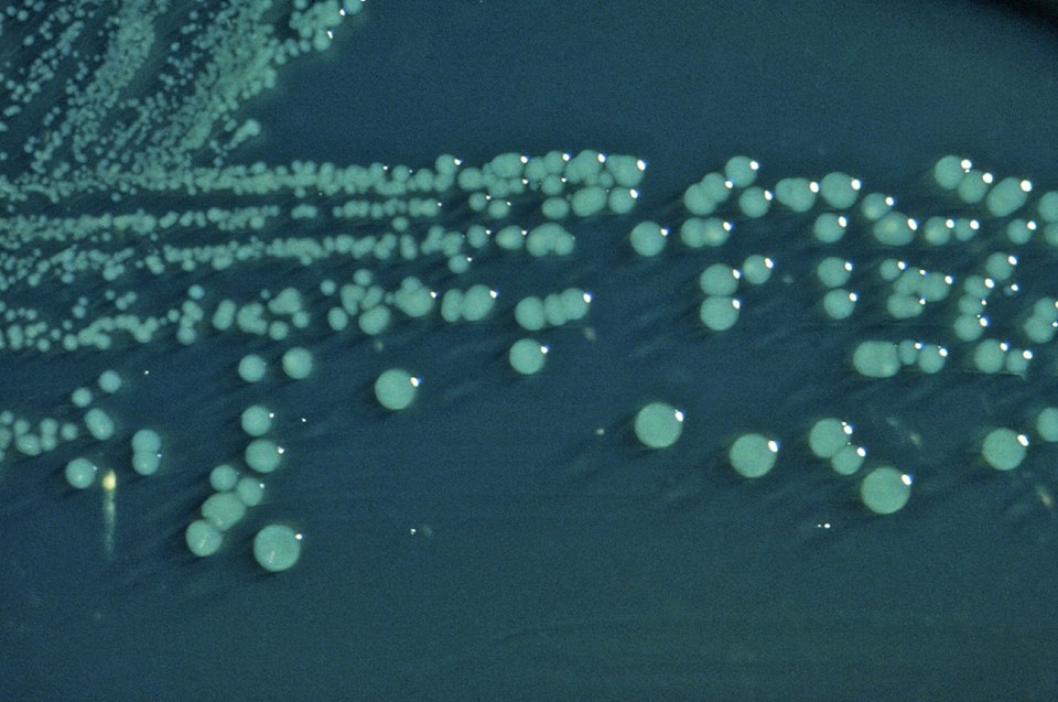 Shigella boydii 01