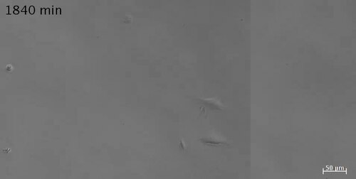 Supplementary Movie 3 Time-lapse of FACS cell sorted control (healthy) Tg:Pax7nGFP mouse plated in septic mouse serum.