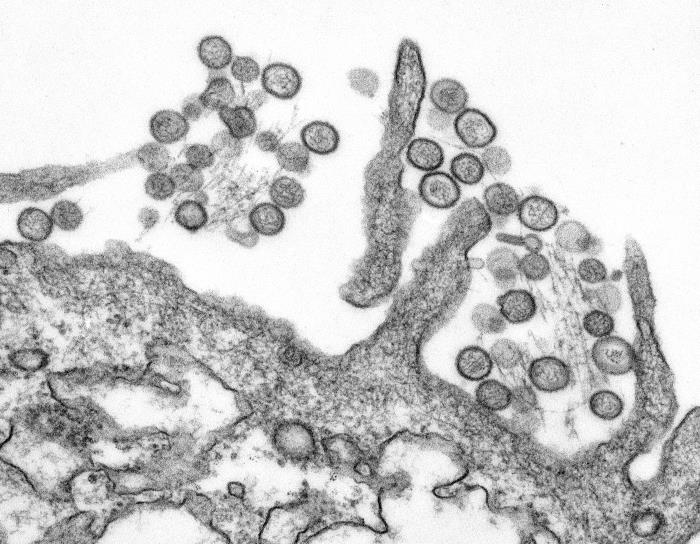 Transmission electron micrograph of the Sin Nombre Hantavirus.
Hantaviruses that cause Hantavirus pulmonary syndrome (HPS) are carried in rodent droppings, especially the deer mouse. Incubation lasts for 1–5wks. Sickness begins with fever and muscle aches, followed by shortness of breath and coughin