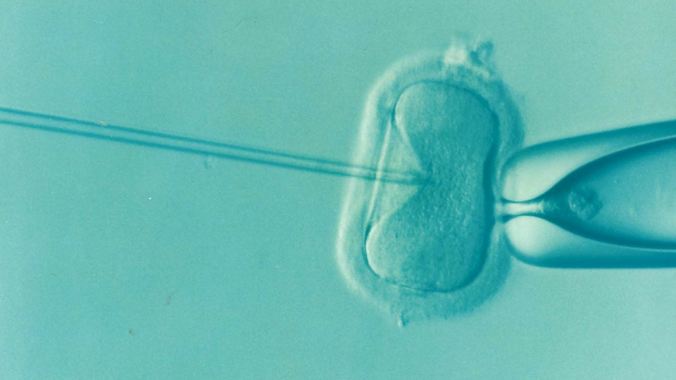 Injecting sperm into a human egg