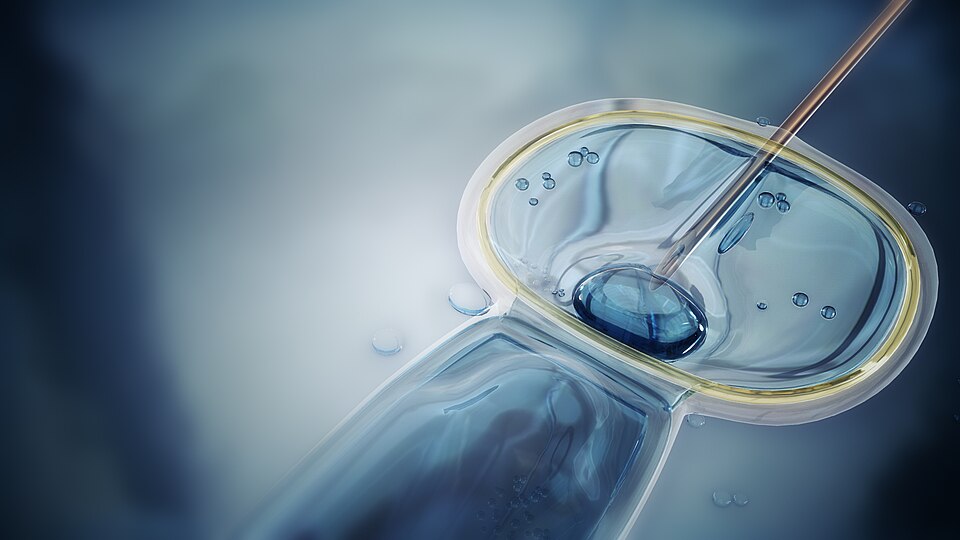 In-vitro fusion of sperm and egg.
