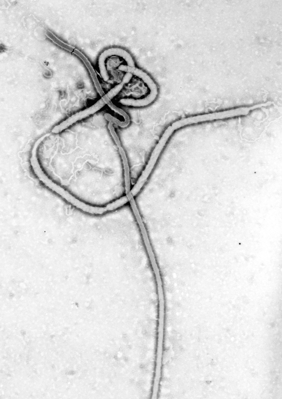 An electron micrograph of an Ebola viral particle showing the characteristic filamentous structure of a Filoviridae. The viral filaments can appear in images in various shapes including a 'u', '6', a coil, or branched resulting in pleomorphic particles. The filaments are reported to be between 60-80