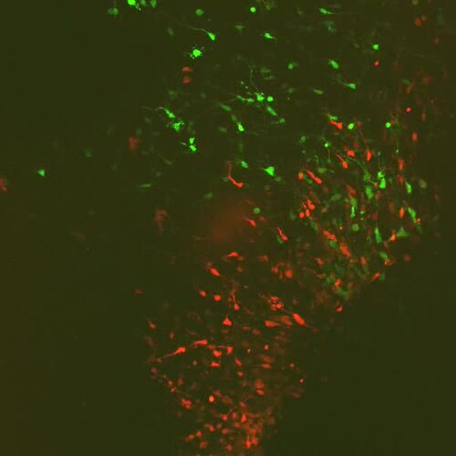 HKU Engineers Achieve Eightfold Speed Increase in 3D Brain Imaging Using Less Light