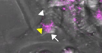 GBM cells merge with brain pericytes on laminin-coated silicone substrates. Magnification of a detail from Video 4, showing the step-by-step sequence of a merging between a tumor cell and a pericyte. The FR dextran+-cytoplasm from a U87 cell (white arrowheads) is progressively transferred (yellow ar
