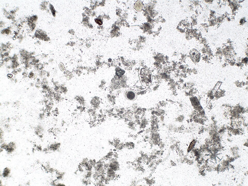 Scientists Engineer Hookworms to Deliver Medicine Inside Animal Hosts