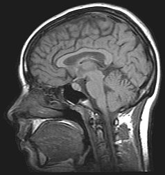 Short Videos Harm Learning and Memory More Than Longer Videos
