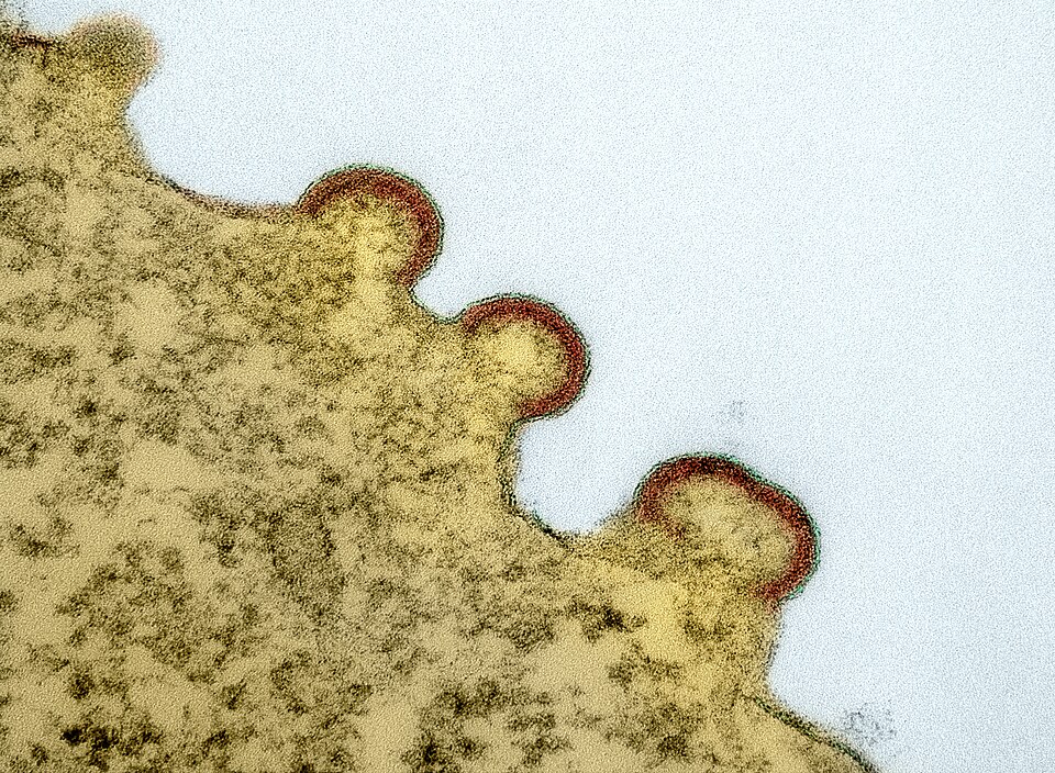Colorized transmission electron micrograph of HIV-1 virus particles (red and green) budding from the plasma membrane of an infected H9 T cell (yellow). Image captured and colorized at the NIAID Integrated Research Facility (IRF) in Fort Detrick, Maryland.  Credit: NIAID