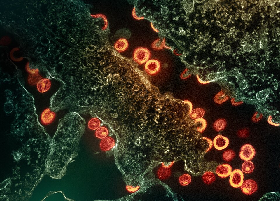 Scientists Find New Location Where HIV Hides in the Body