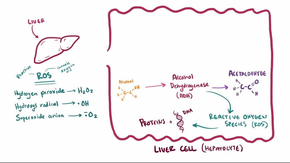 What is alcoholic hepatitis? Well, chronic alcohol consumption puts serious strain on the liver and is one of the leading causes of liver disease and cirrhosis in Western nations. Liver cells forced to constantly process alcohol undergo a series of events leading to immune destruction, fatty deposit