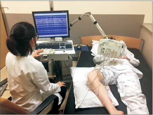 This image shows a 10-channel dynamic polyelectromyography which may be a useful method for selecting the dominant dystonic muscles. A 49-year-old post-stroke female patient showed paroxysmal repetitive contractions involving the right leg which may be of dystonic nature according to the electromyog