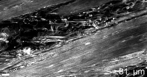 Muscle Protein Discovery May Offer Clues to Aging and Physical Strength