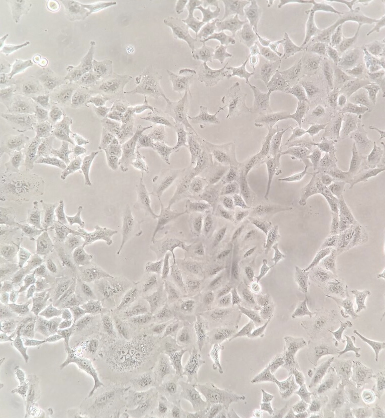 A549 cells are isolated from the lung tissue of a 58-year-old Caucasian male with lung cancer. Use this cell line for your cancer, immuno-oncology, and toxicology research and high-throughput screening.
