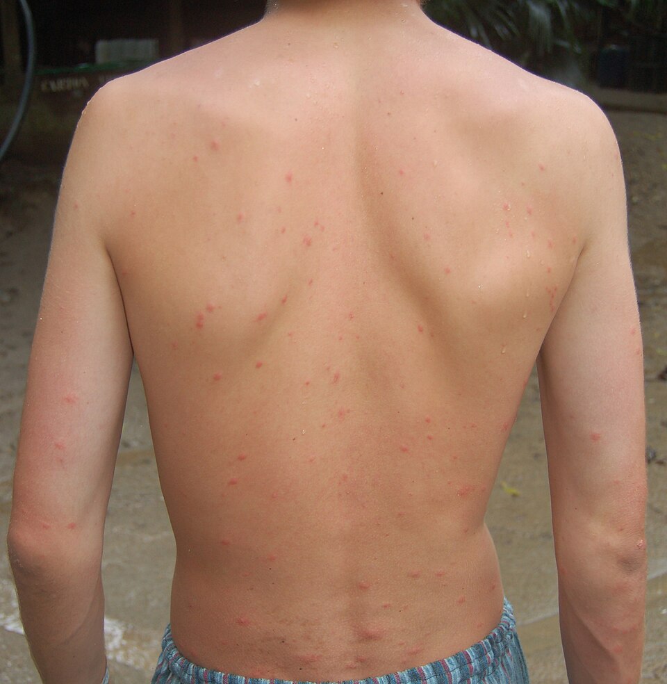 One night in Tayrona National Natural Park resulted in a mosquito-bitten back even though it was protected by t-shirt, bed sheet and hammock.