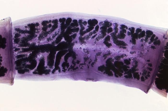 Under a very low magnification of only 8X; this photomicrograph revealed some of the ultrastructural morphology exhibited by three Taenia solium proglottids. Proglottids of Taenia spp. Gravid proglottids are longer than wide and the two species, T. solium and T. saginata, differ in the number of pri