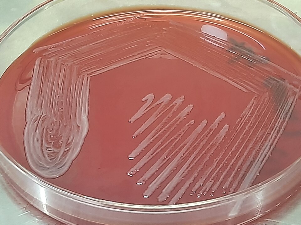 Smooth, opaque, grayish-white colonies of Acinetobacter baumannii complex observed on blood agar from sputum culture, showing characteristic non-hemolytic morphology.