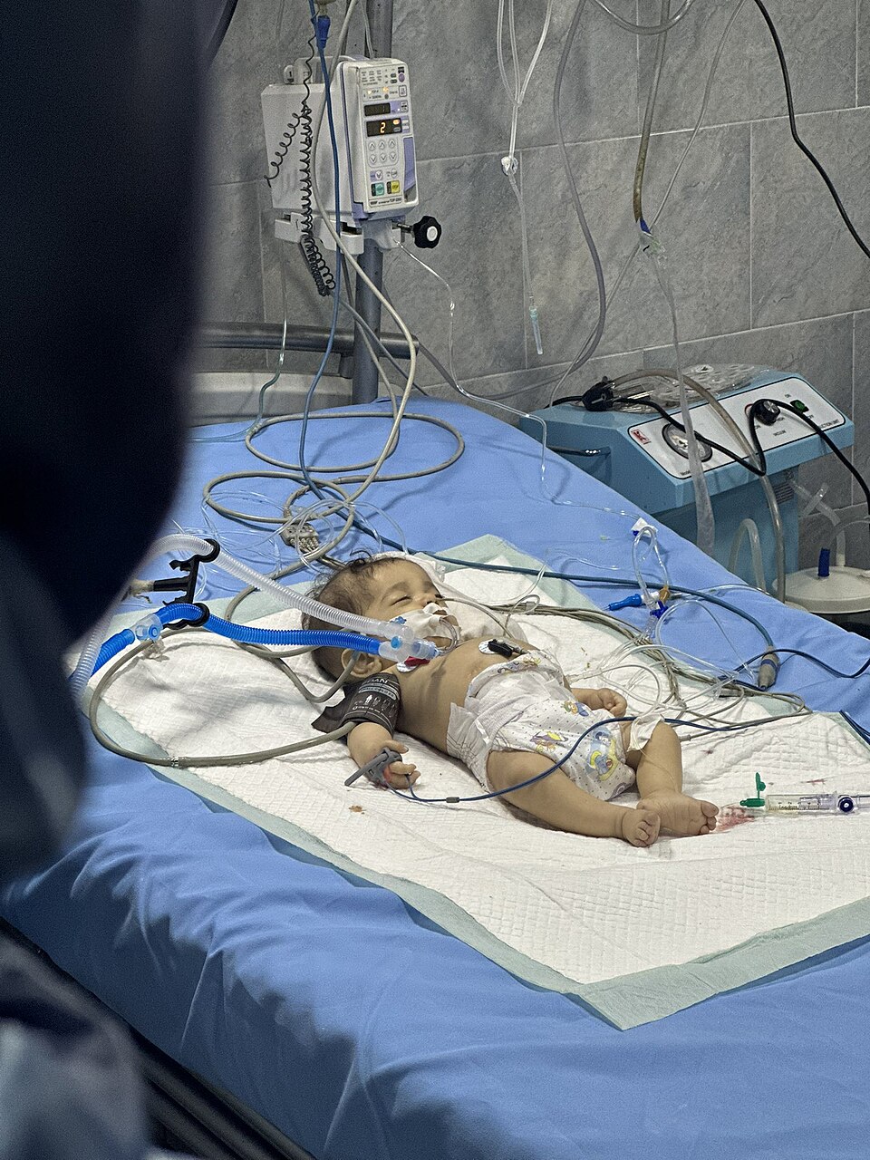 Jailed Gaza Hospital Director in Critical Condition After 555 Days, Son Says