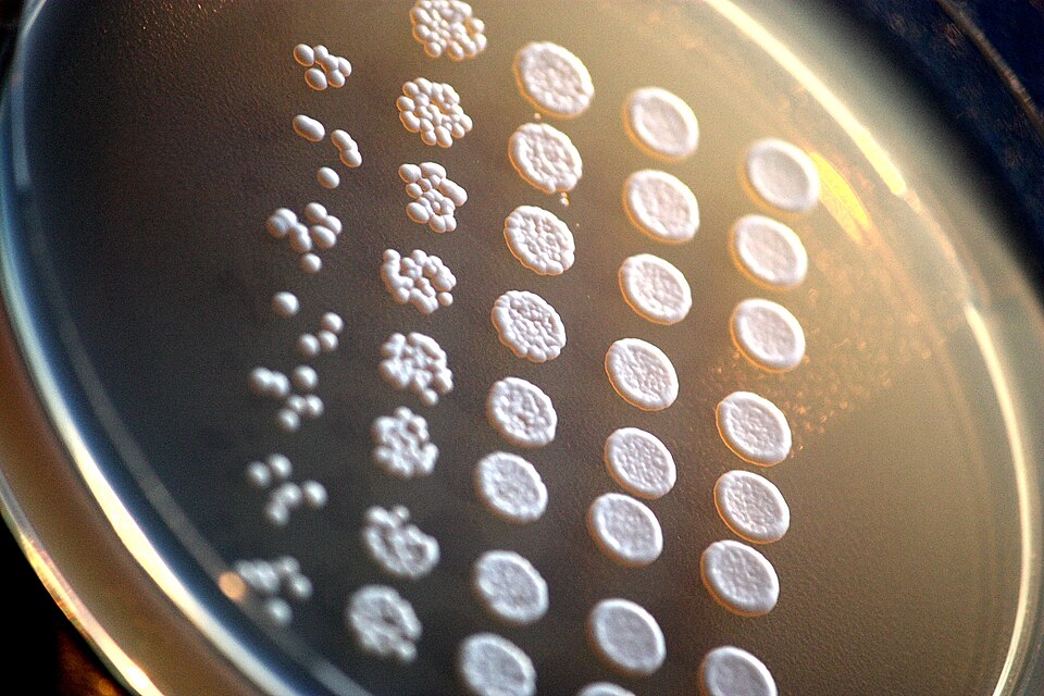 Drop-inoculation of laboratory baker´s yeast (Saccharomyces cerevisiae) mutants on agar plate. The assay called "frogging" compares the viability of different yeast mutants.