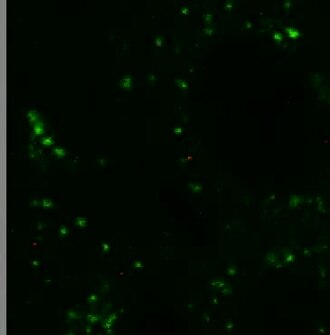 Ebola Treatment Research Accelerates as Scientists Race to Find a Therapy
