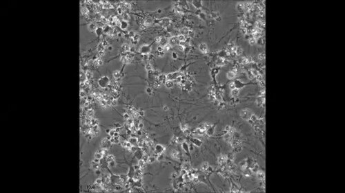 Uninjured cell cultures display less proliferation and no directional migration. Neurons, recognized by their round to oval somal shape and their extending axon and dendrites, migrate aimlessly and less fervently in uninjured cultures than injured ones. Although, proliferation is observed also in un