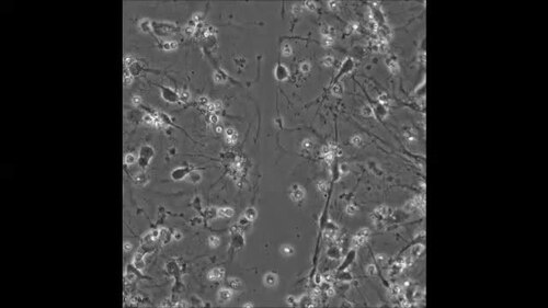 Researchers Identify Mechanism That May Explain How Alzheimer's Kills Brain Cells