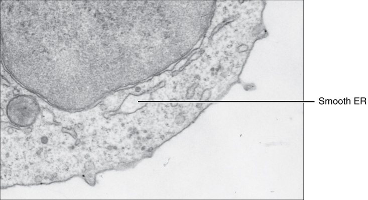 Caption:  (a) The ER is a winding network of thin membranous sacs found in close association with the cell nucleus. The smooth and rough endoplasmic reticula are very different in appearance and function (source: mouse tissue). (b) Rough ER is studded with numerous ribosomes, which are sites of prot