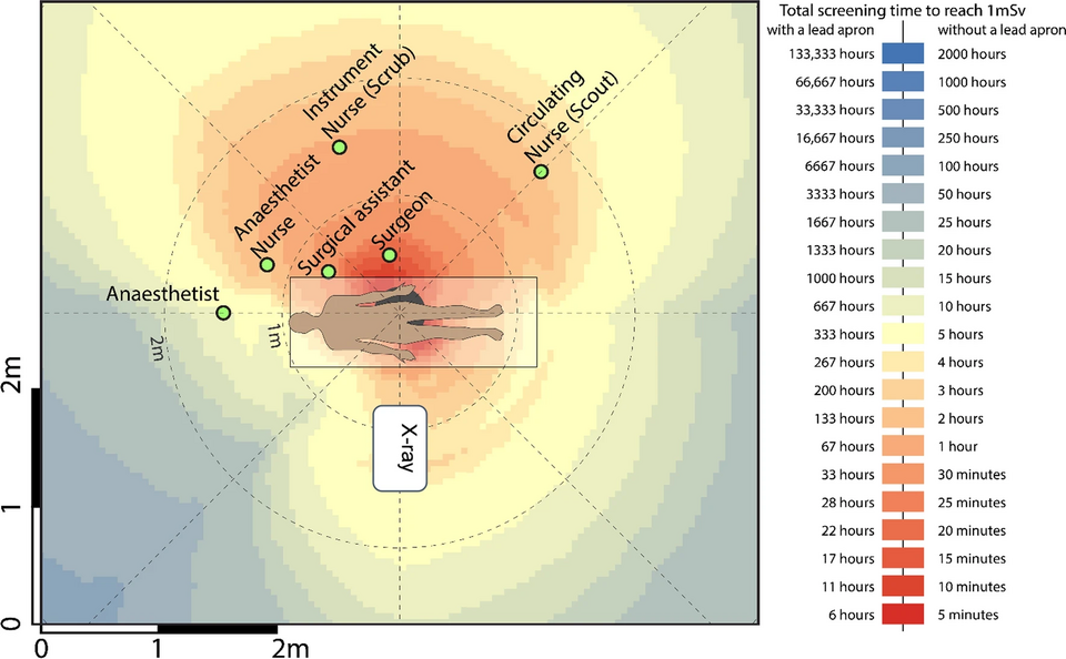 Heatmap of dose distribution for hip replacement and hip arthroscopy surgery
