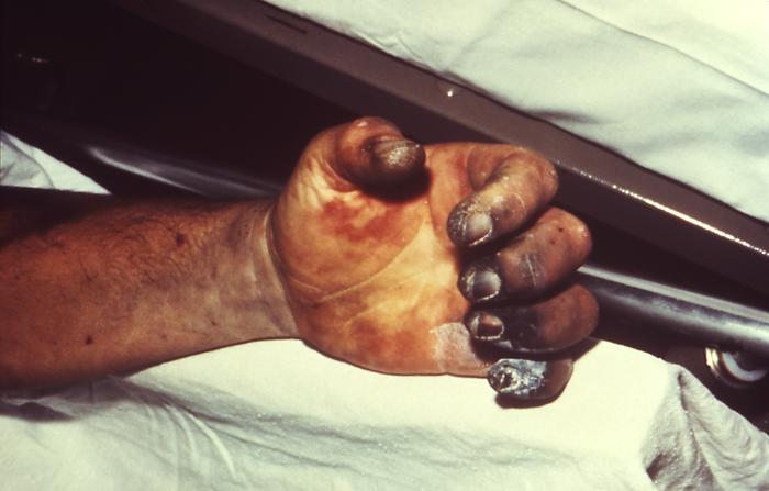 Wild Rat Tests Positive for Plague in New Mexico, Health Officials Warn Residents