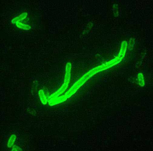 Yersinia pestis im Fluoreszenz-Mikroskop
mit Fluoreszenz-markiertem Antikörper gegen ein Kapsel-Antigen