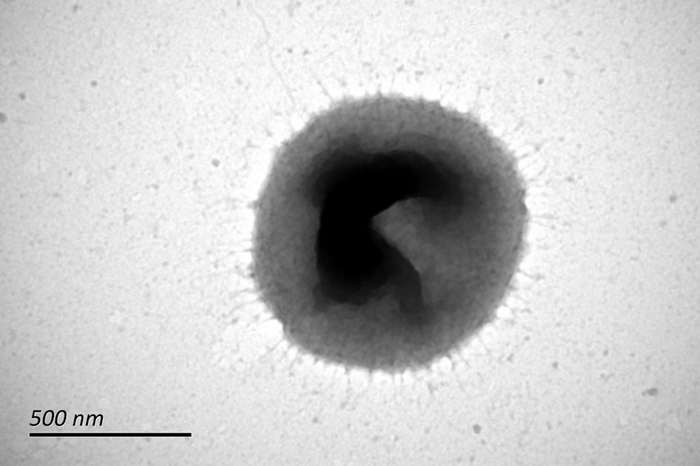 The photo represents a micrograph of novel Neisseria species, Neisseria chenwenguii