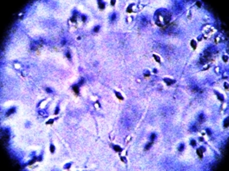 Sperm