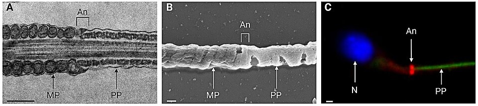 Fig. 2 Annulus microscopy. A Longitudinal section of mouse flagellum in transmission electron microscopy. Scale bar: 500nm. B Mouse flagellum in scanning electron microscopy. Scale bar: 200nm. C Immunofluorescence detection of the annulus in human sperm (SEPT4 in red, principal piece in green, DNA i