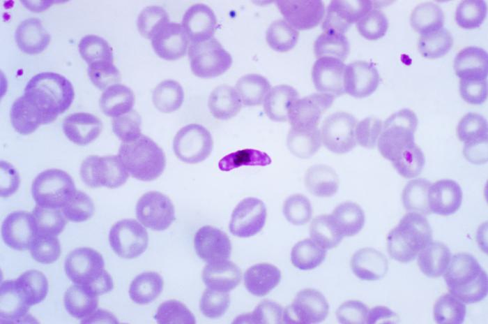 ID#:	2701
Description:	A photomicrograph of a blood smear containing a macrogametocyte of the parasite Plasmodium falciparum.
A macrogametocyte is a product of the erythrocytic life cycle. Both the male and female gametocytes can be ingested by an Anopheles sp. mosquito, whereupon, exflagellation of