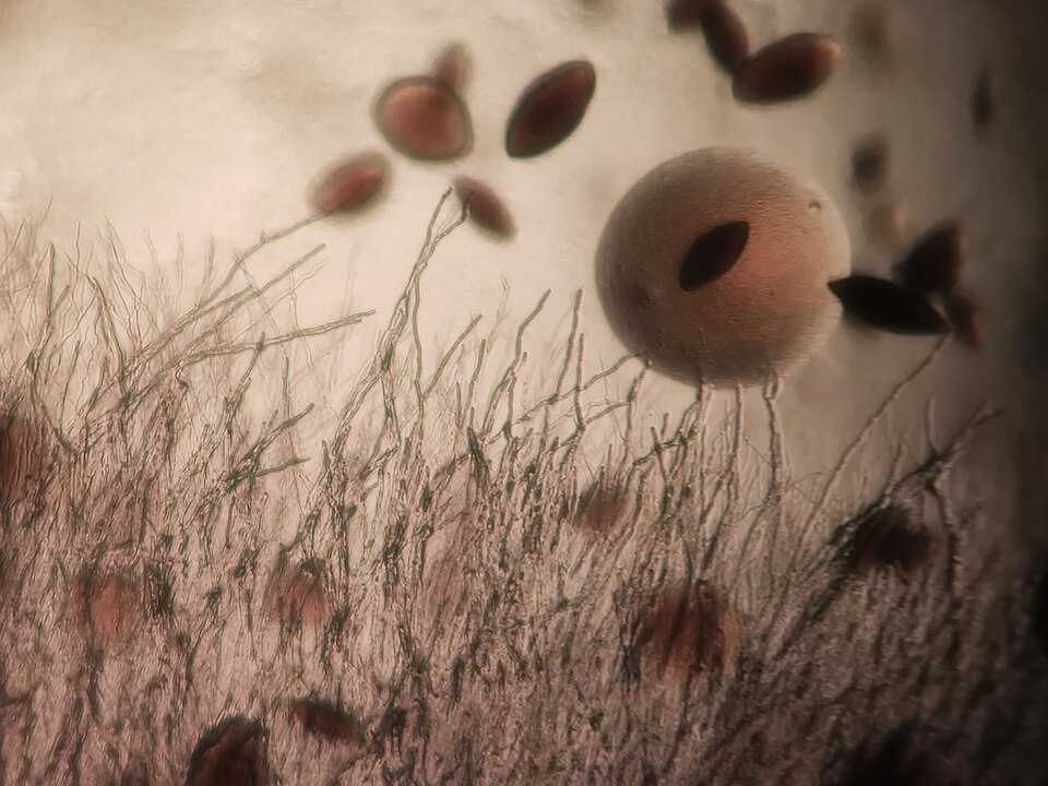 Bacteria yeast and fungi, microscope image