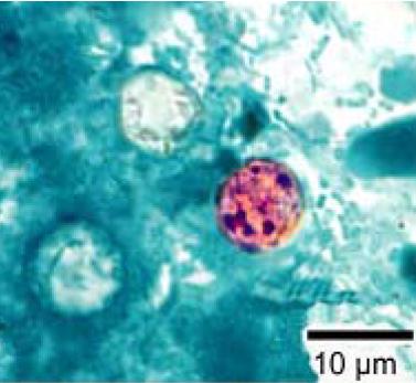 This photomicrograph of a fresh stool sample, which had been prepared using a 10% formalin solution, and stained with modified acid-fast stain, revealed the presence of four en:Cyclospora cayetanensis oocysts in the field of view. Compared to wet mount preparations, the oocysts are less perfectly ro
