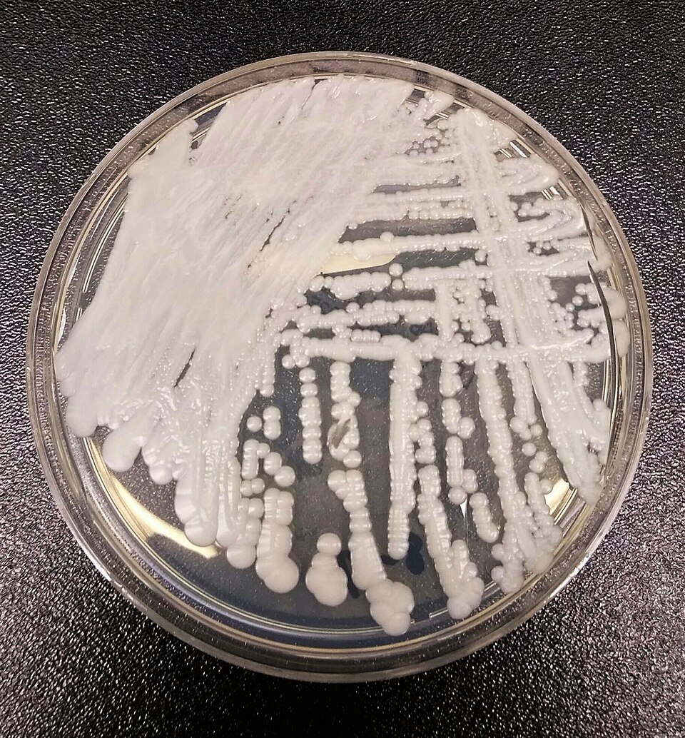 A strain of Candida auris cultured in a petri dish at a CDC laboratory.