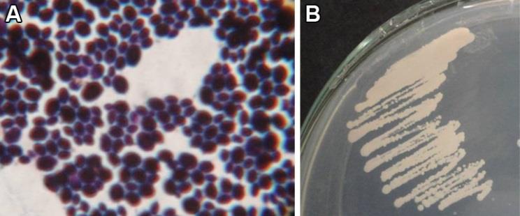 Deadly Drug-Resistant Fungus Candida Auris Spreads to 27 States
